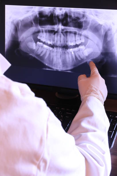 Emergency Gum Pain Relief in LA