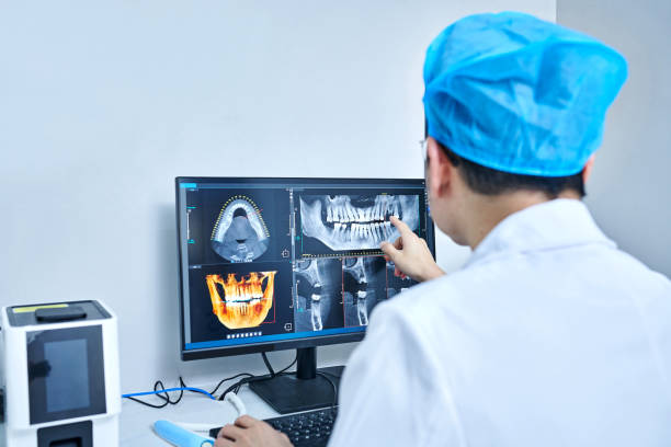 Best Chipped Tooth Repair Near Me  in Brownfields, LA