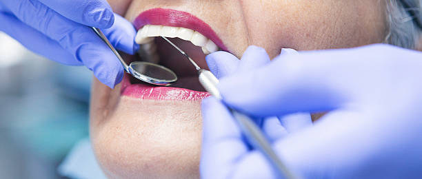 Best Affordable Emergency Dental Care  in Brownfields, LA